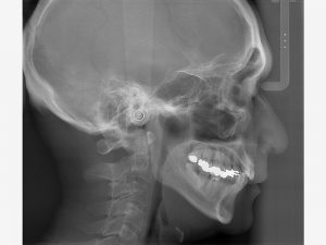 JMMC_Veraview_X800_feature_48