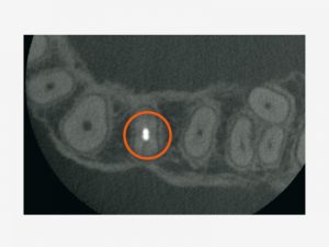 Products_Veraview-X800_features_11