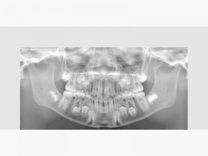 Products_Veraview_X800_features_05