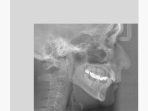 Products_Veraview_X800_features_08